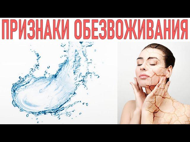 ПРИЗНАКИ ОБЕЗВОЖИВАНИЯ | Как распознать обезвоживание