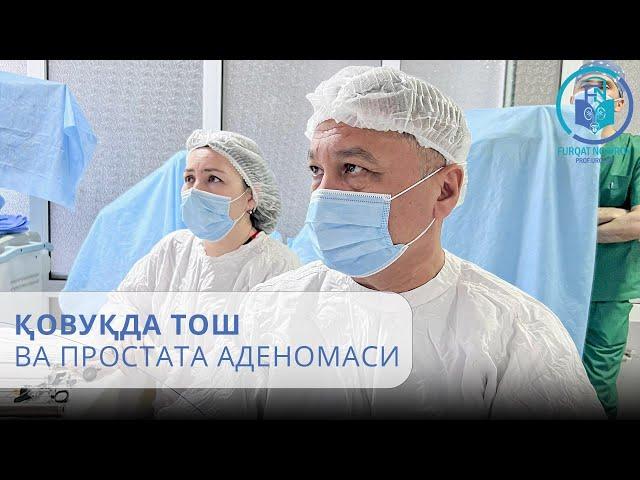 Қовуқда тош ва простата аденомаси