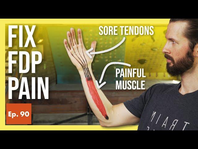 How to Fix an FDP Injury for Climbers (Pain in Finger, Hand, or Forearm)