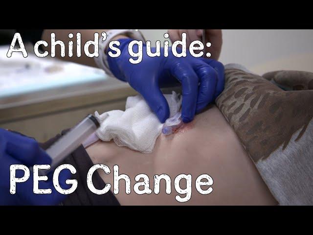 A child's guide to hospital: PEG Change