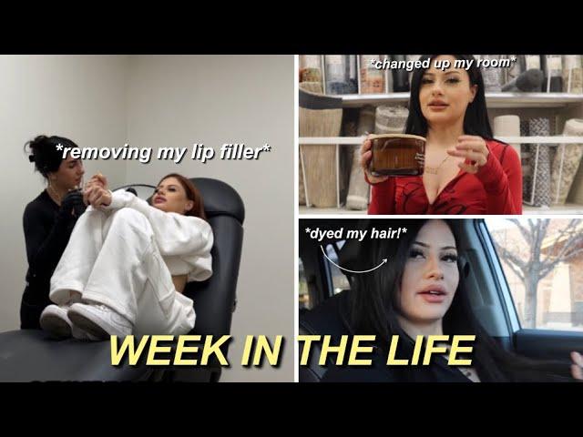 WEEK IN MY LIFE | dying my hair, redecorating my room, lip filler removed