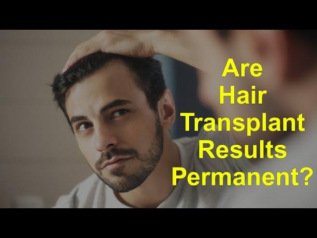 Are Hair Transplant Results Permanent?