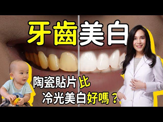 牙齒美白:陶瓷貼片比美白貼或冷光美白好嗎?｜林榆芩醫師