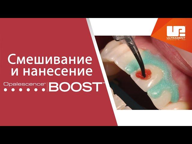 Смешивание и нанесение офисного отбеливания Opalescence™ Boost™