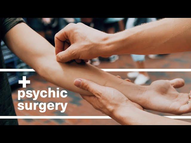 Psychic Surgery by Aaron Alexander (Perform Invisible Surgery on Strangers)