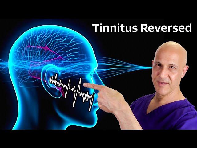 Tinnitus Reversed:  The Miracle of 1 Nutrient!  Dr. Mandell