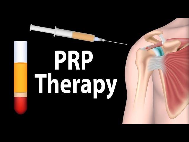 PRP Therapy Animation