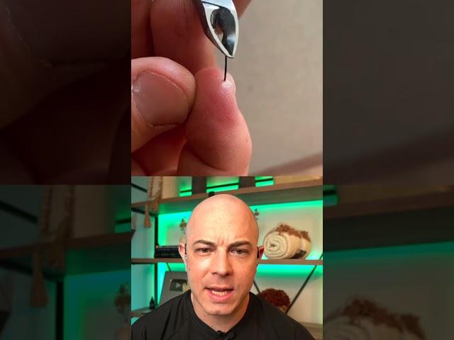 Derm reacts to a smooth splinter removal! #dermreacts #doctorreacts #splinter #satisfying