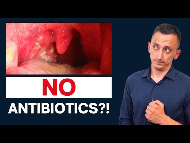 Antibiotics for Strep Throat: Do We Need Them?