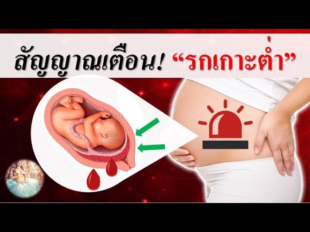 อาการคนท้อง : สัญญาณ "รกเกาะต่ำ" | อาการคนตั้งครรภ์ | คนท้อง Everything