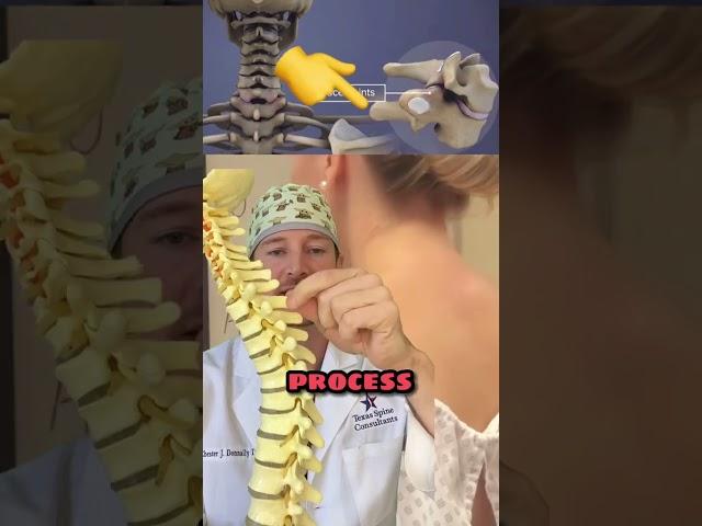 What is the bump on the back of your neck?! (Spine expert explains) 