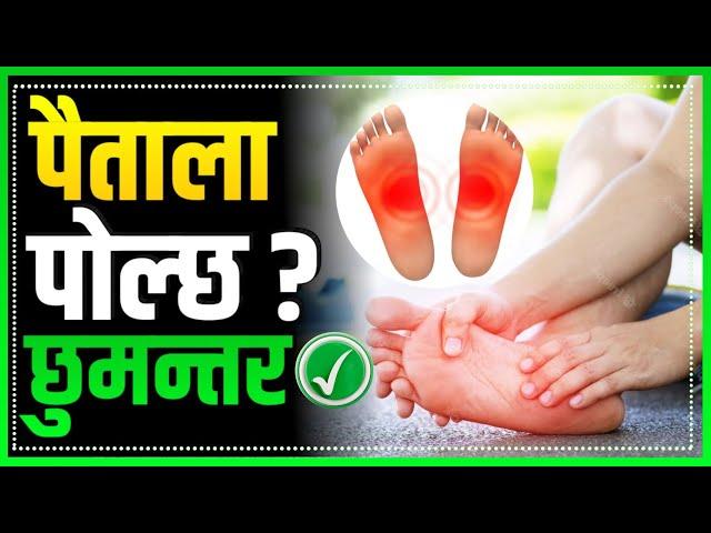 अब पैतला पोल्ने समस्या बाट मुक्ती || Burning feet/foot pain cause and treatment  in Nepali