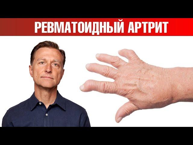 13 натуральных средств от ревматоидного артрита