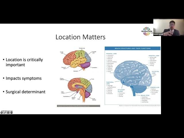 The Glioblastoma Brain Cancer Patient Journey DEMYSTIFIED.