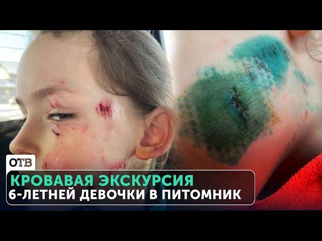 Собака укусила 6-летнюю девочку за лицо во время экскурсии в питомник