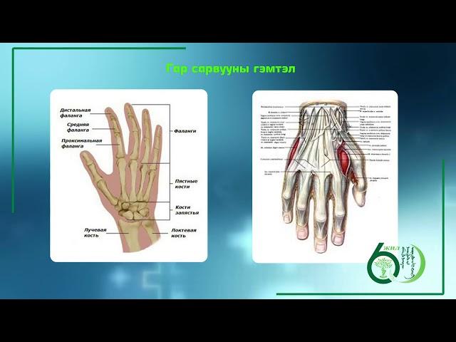 ГССҮТөвийн Гар сарвууны гэмтэл, согогын тасгийн их эмч Б.Мөнхбат: