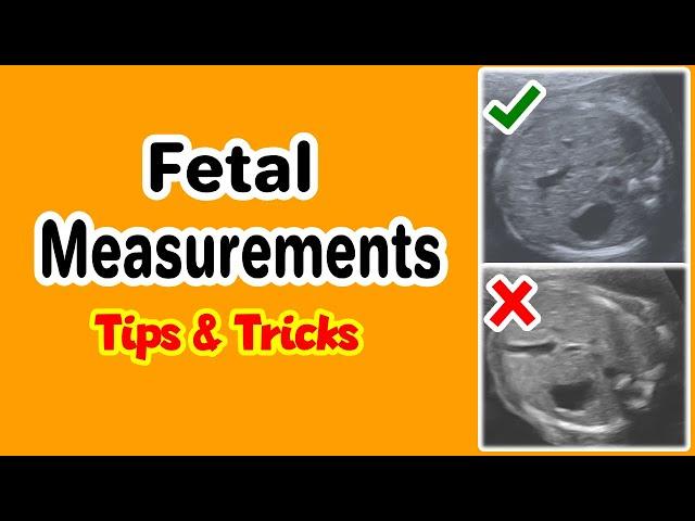 Fetal Measurements, Tips and Tricks