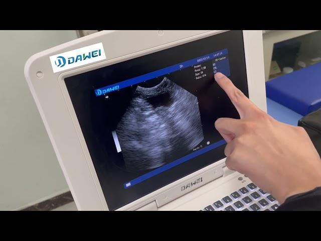 Vet Ultrasound Machine- Compact, Clear, and Convenient!
