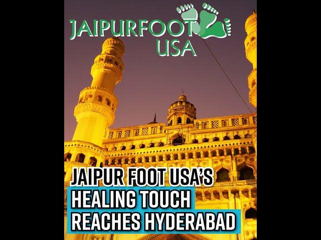 Jaipur Foot USA's next stop in Hyd; historic limb fitment camp to mark 75 years of Independence