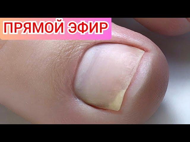 Педикюр. Прямой Эфир Виктория Авдеева