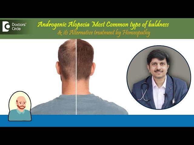 Baldness|Androgenic Alopecia|Alternative Treatment by Homeopathy -Dr.Sanjay Panicker|Doctors' Circle