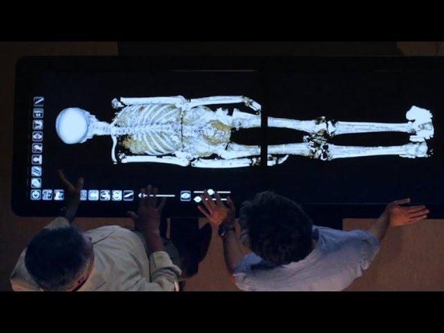 Revealed: How King Tut Died