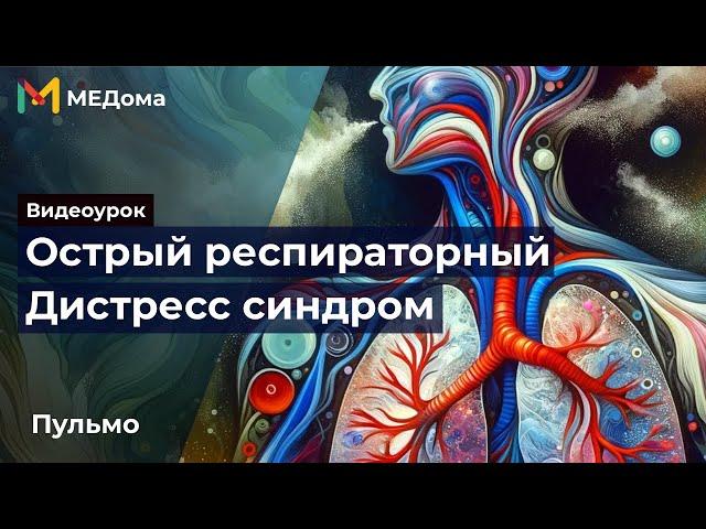 Острый респираторный дистресс синдром - ОРДС: патогенез, причины, лечение | Медома | USMLE step 1