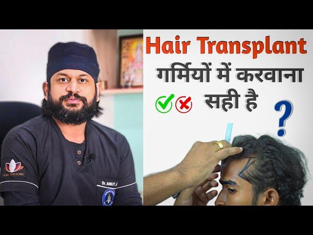 Hair Transplant in Summer ?? गर्मियों में हेयर ट्रांसप्लांट करवाना सही है || ?