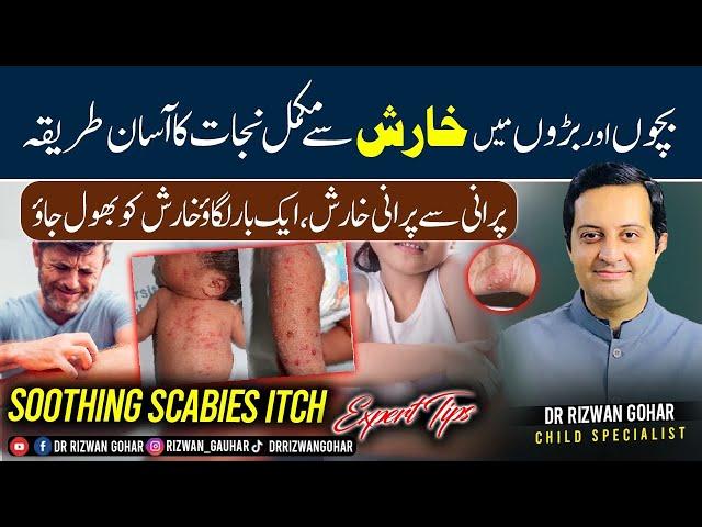 How to stop itching with expert advice #Scabies #treatment