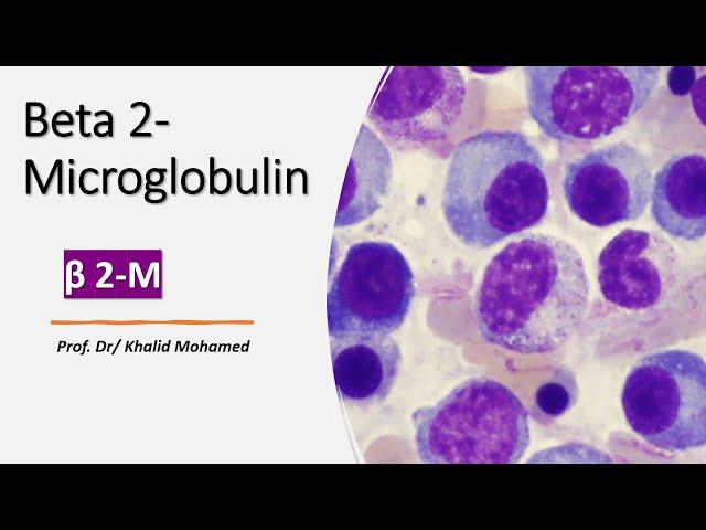 Beta-2 Microglobulin (ß2-M) Test