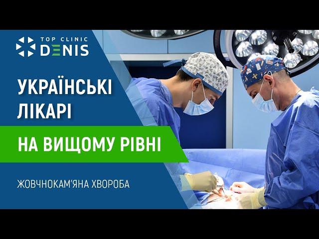 Українські лікарі на вищому рівні - лікування жовчнокам'яної хвороби | TOP Clinic DENIS