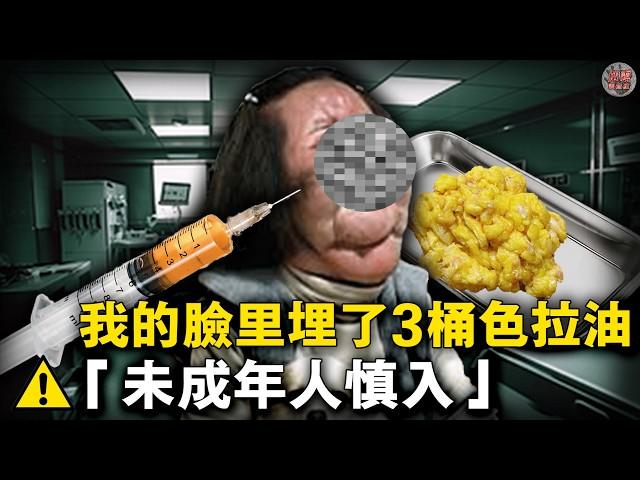 韓國頂流模特神似王祖賢，十年整形上百次親手往臉上打食用油終毀容！17次手術取出3.5公斤異物，你敢看嗎？【迷霧調查組】韓國案件 案件推理 案件分析