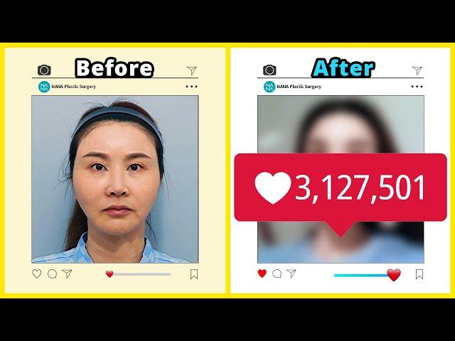 EP 4  Korea Plastic Surgery Before and After photos | Makeover transformation 