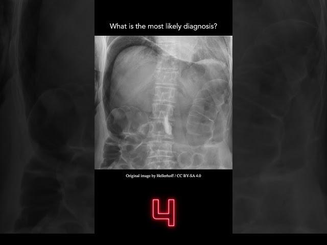 Abdominal X-ray Question 1