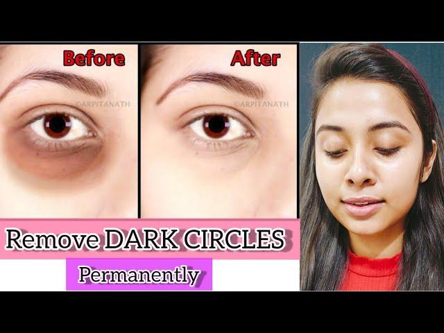 Remove Dark Circles Permanently In A Week #shorts #youtubeshorts | Devanshi kalra