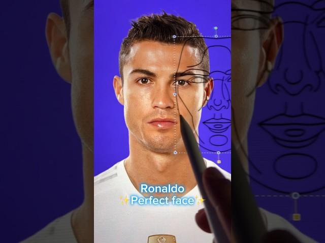Ronaldo perfect face surgery!