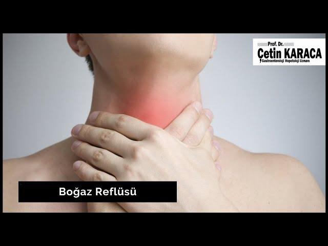 What is Throat Reflux? | Throat Reflux | Throat Reflux Symptoms | Prof. Dr. Cetin Karaca