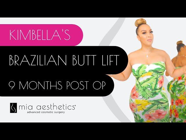 Kimbella's BBL - 9 Month Post Op - Brazilian Butt Lift Before & After By Dr. Mehio At Mia Aesthetics