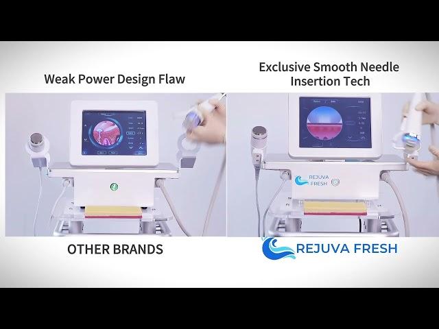 Test of Microneedling Safety & Effectiveness | Rejuva Fresh vs. Other Brands