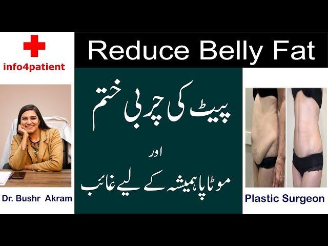 Charbi kaise khatm hogi - Plastic Surgeon in Lahore - Dr. Bushra Akram