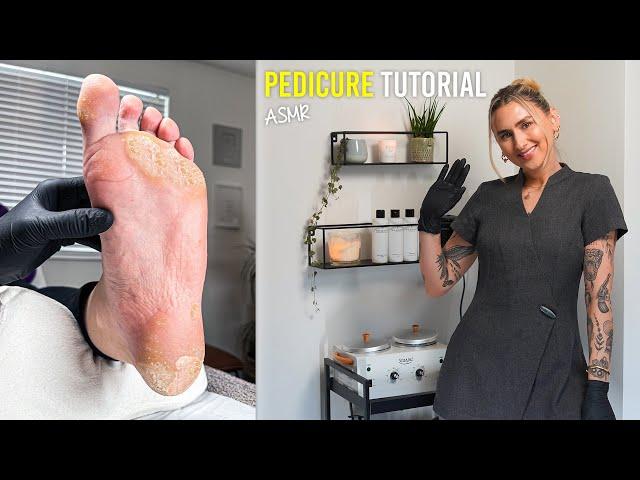 Restoring Heavily Worn Damaged Feet Back To Life