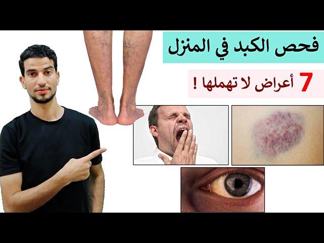 افحص كبدك في المنزل في دقائق _ انتبه لاعراض خطيرة تلزم الطبيب