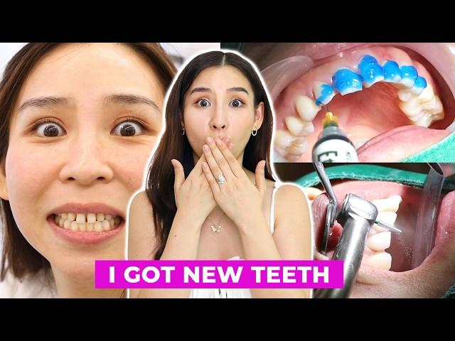 I Got a Dental Makeover in Korea  