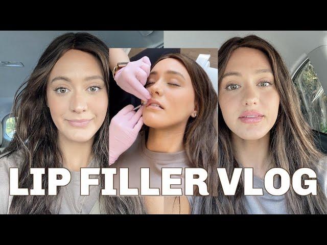 LIP FILLER VLOG | Before and after + the healing process!