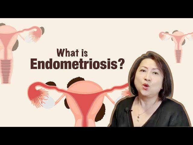 What is Endometriosis?