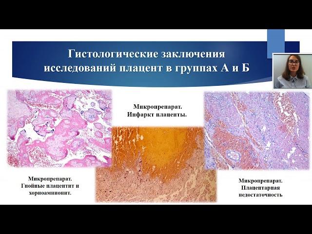 ИТОГИ ОПЕРАТИВНОГО РОДОРАЗРЕШЕНИЯ ПРИ ПРЕЖДЕВРЕМЕННЫХ РОДАХ