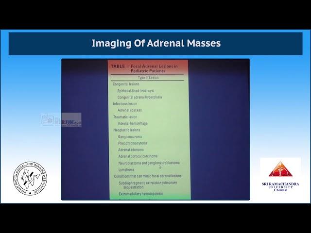 Imaging Of Adrenal Masses