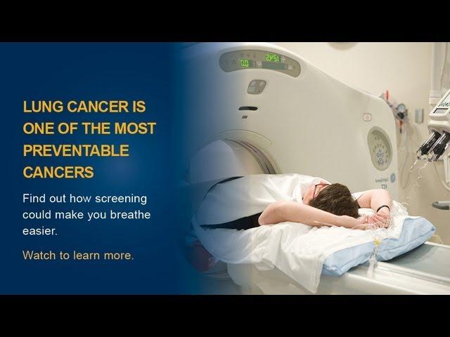 Lung Cancer Screening