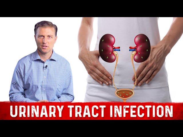 Best Home Remedy for Urinary Tract Infection (UTI) – Dr. Berg