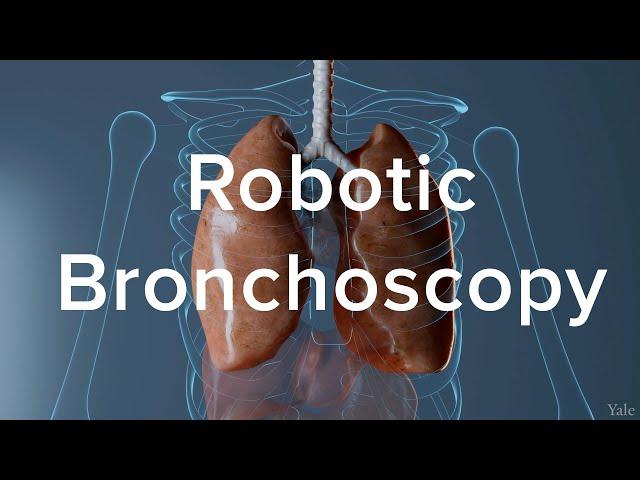 Lung Biopsy Via Robotic Bronchoscopy - Yale Medicine Explains